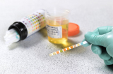 Urine Tests
